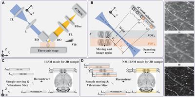 Axial resolution and imaging contrast enhancement in inverted light-sheet microscopy by natural illumination modulation